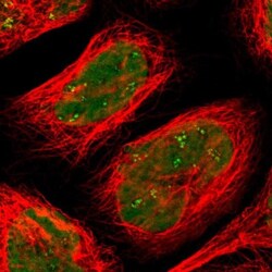 SMARCA5/SNF2H Antibody, Novus Biologicals 25 &mu;L; Unlabeled:Antibodies,